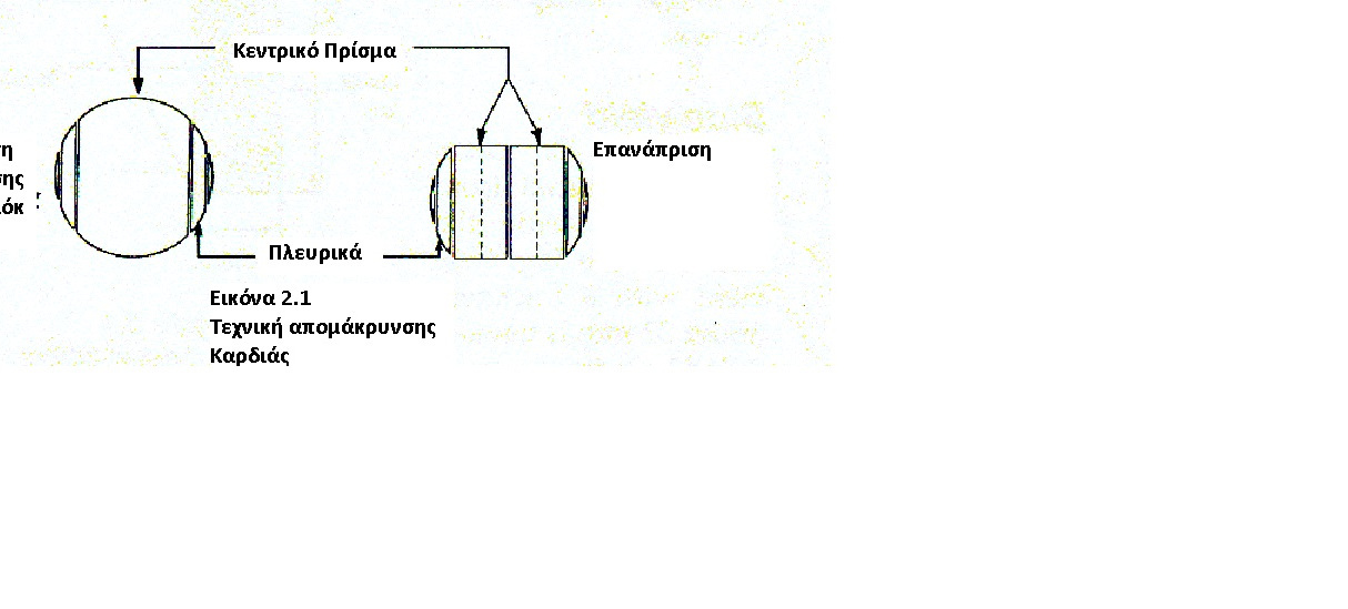 Τεχνική Πρίσματος 